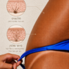 Melanotan 2 — pigmentation research infographic
